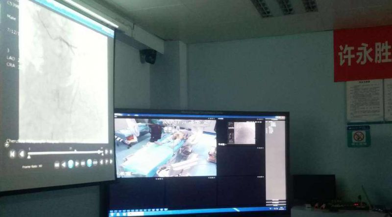 手术示教系统厂商谁家好